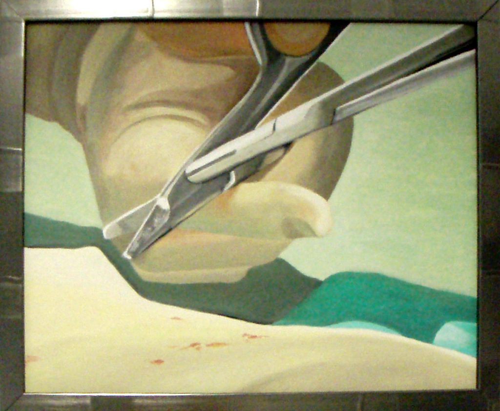 Surgical Artwork Commissioned by Sir. Ara Darzi at St. Mary’s Hospital, Paddington, as a series of oil paintings and a wall mural for the Academic Surgical Department.