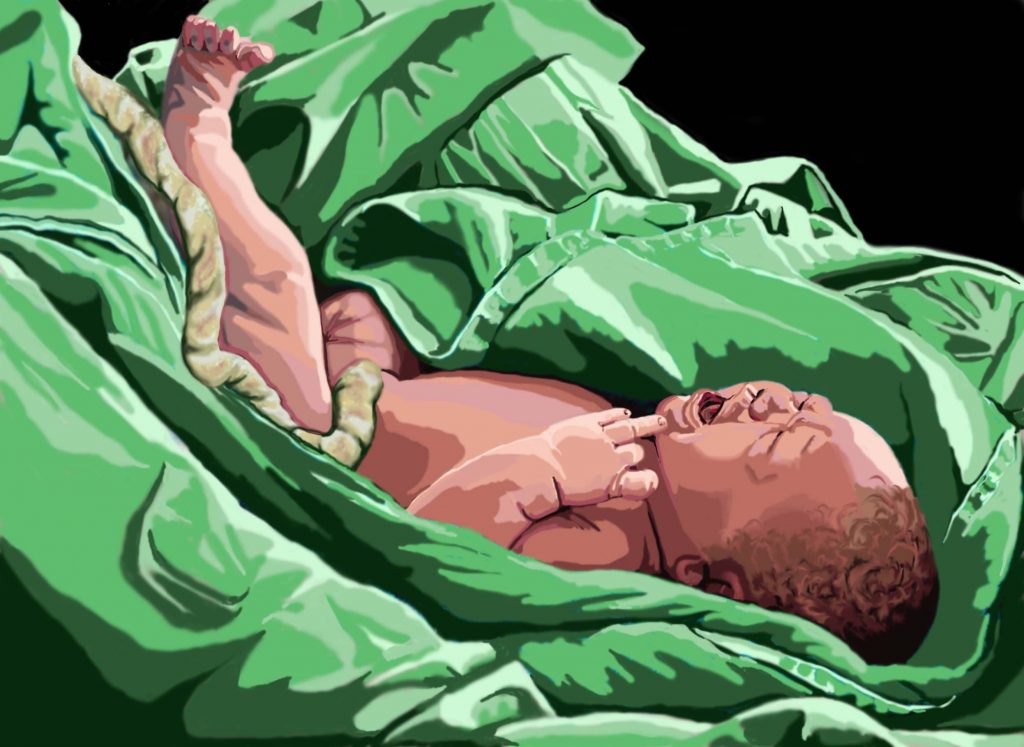 Cord Clamping Medical Illustration